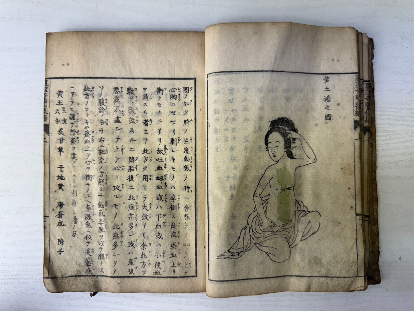 Y9542 WOODBLOCK PRINT Japanese medical book medicine Japan antique academic